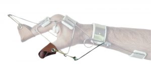Adietamiento extensor del pulgar para férula dinámica de mano